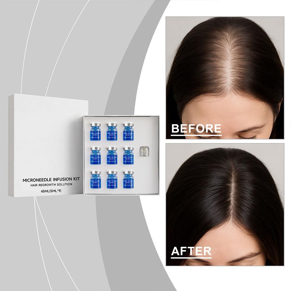 Hair Care Routine - Set di Micro-Aghi con Siero Essenziale