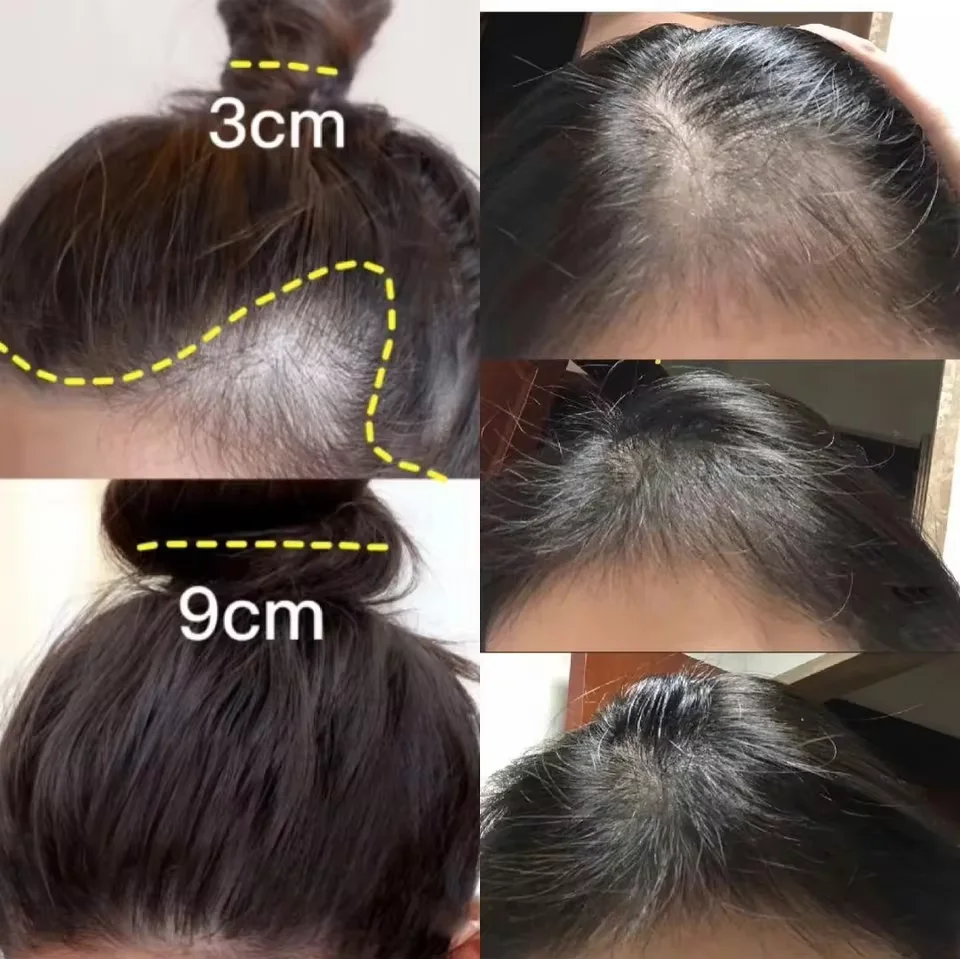 Crema per la crescita dei cape - Hair Care Dupes recensione e prezzo